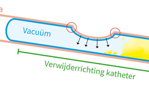 Schematische uitleg